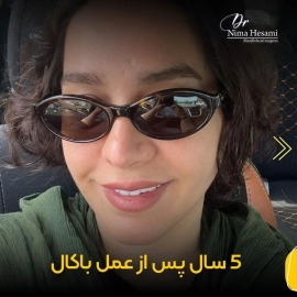 جراحی-بوکال-فت-3