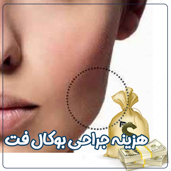 هزینه جراحی بوکال فت - دکتر نیما حسامی