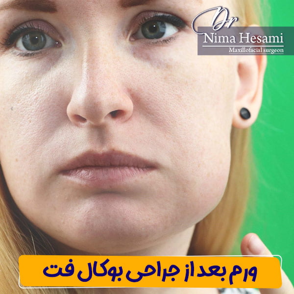 ورم بعد از جراحی بوکال فت - دکتر نیما حسامی