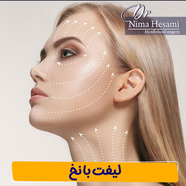 لیفت با نخ - دکتر نیما حسامی