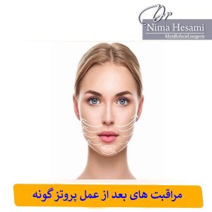 مراقبت های بعد از عمل پروتز گونه _ دکتر نیما حسامی
