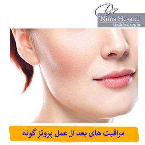 مراقبت های بعد از عمل پروتز گونه _ دکتر نیما حسامی