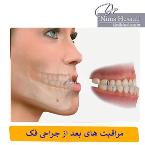 مراقبت های بعد از جراحی فک _ دکتر نیما حسامی