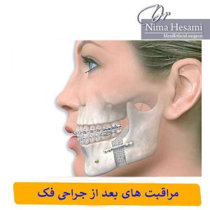 مراقبت های بعد از جراحی فک _ دکتر نیما حسامی