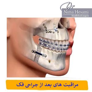 مراقبت های بعد از جراحی فک _ دکتر نیما حسامی