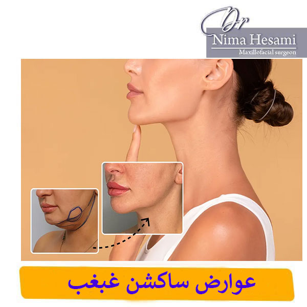 خطرات ساکشن غبغب _ دکتر نیما حسامی