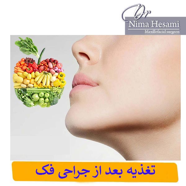 رژیم غذایی بعد از جراحی فک _ دکتر نیما حسامی