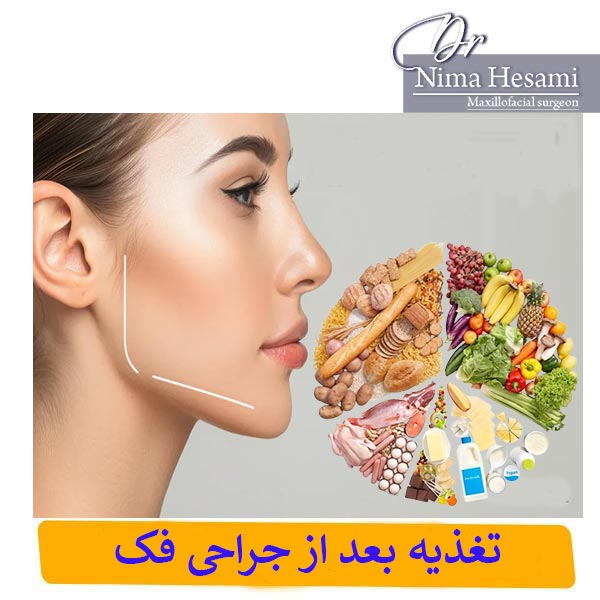 تغذیه بعد از جراحی فک _ دکتر نیما حسامی